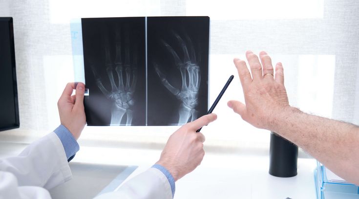 Arzt erklärt Patienten Röntgenbild einer Hand auf dem Computermonitor